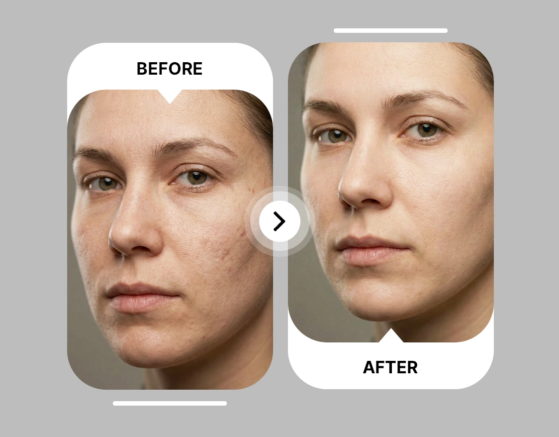Instant AI Skin Retouching With No Watermarks