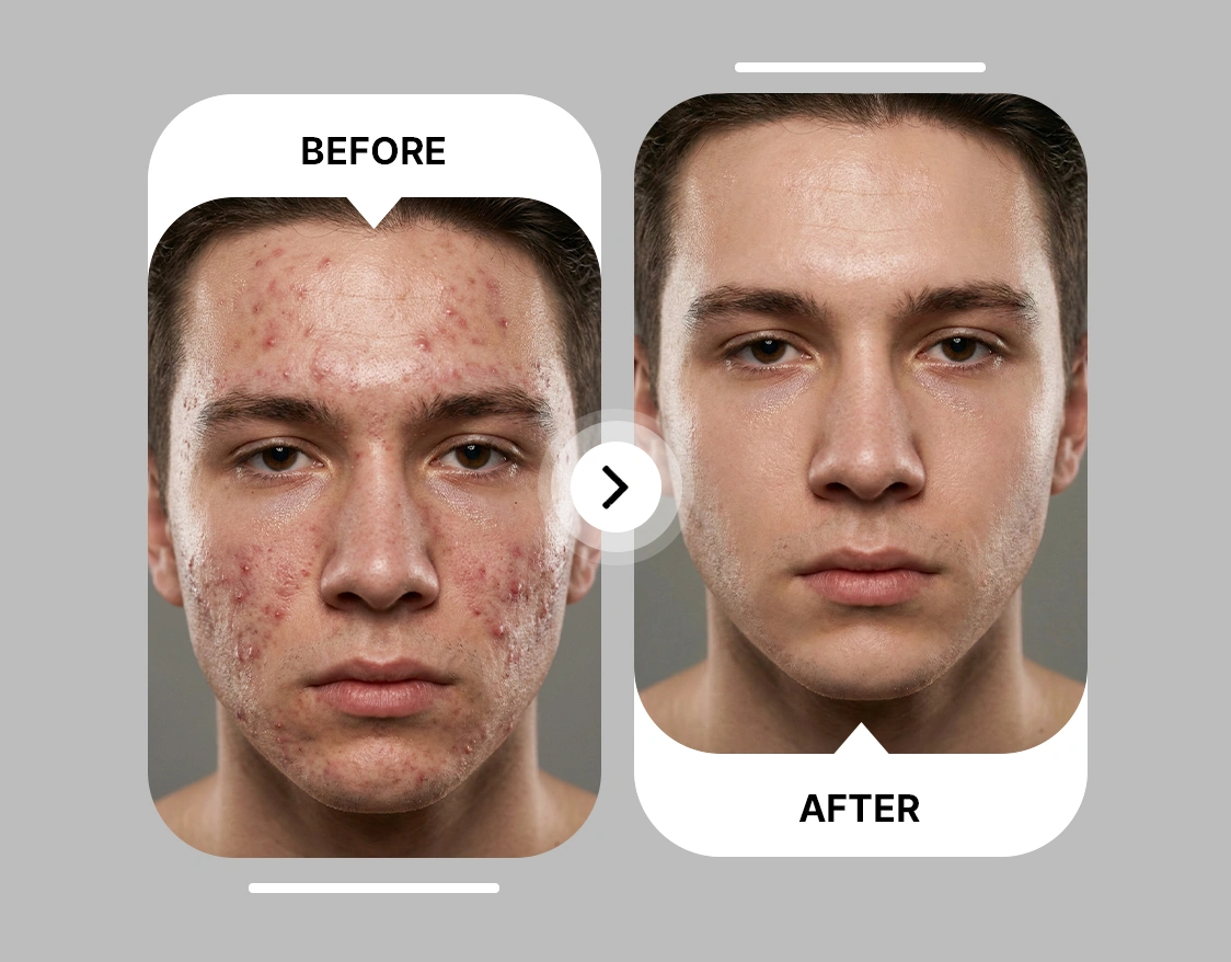 Use AI Photo Retouch With No Editing Skills